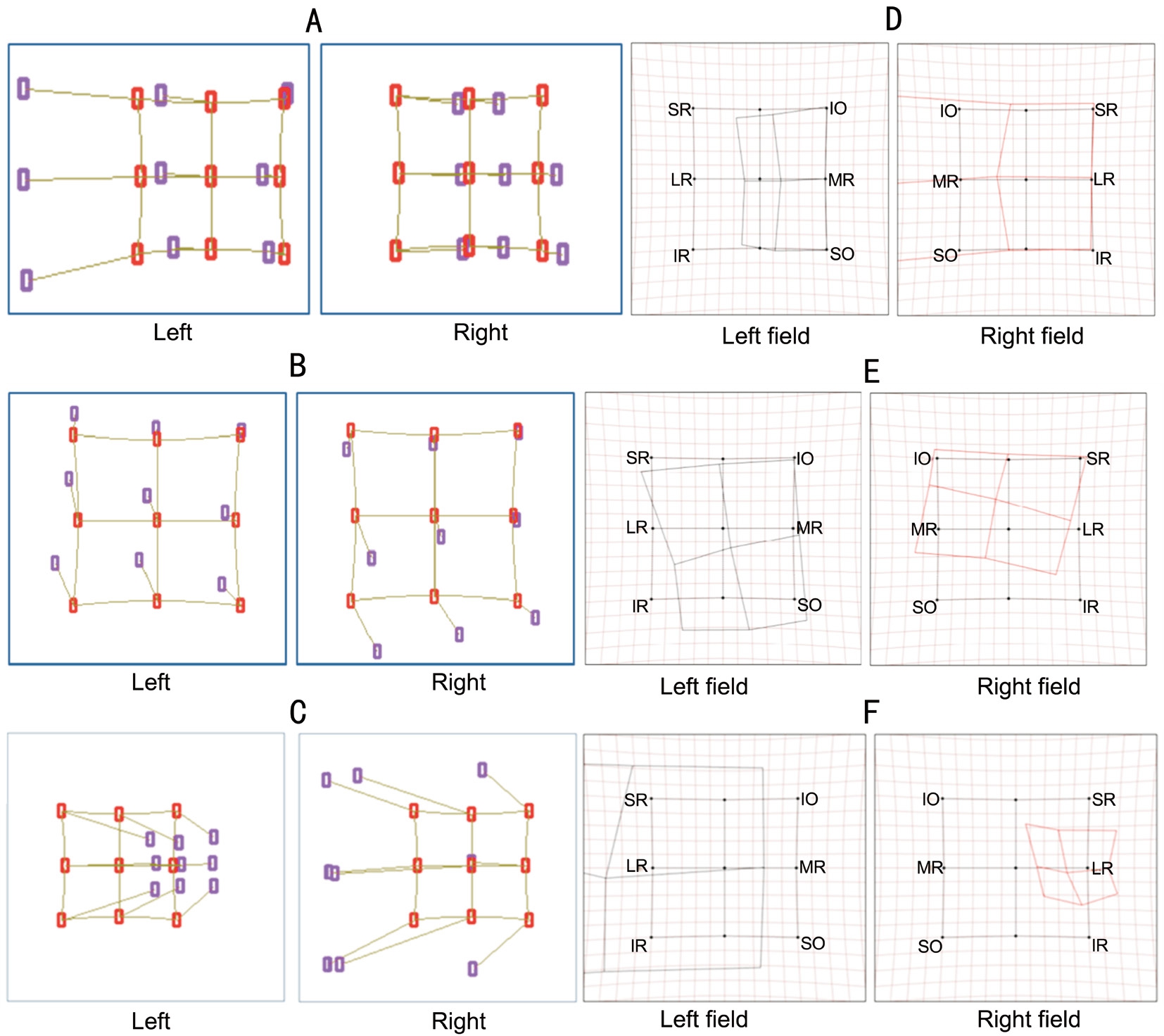 Normal Diplopia Chart