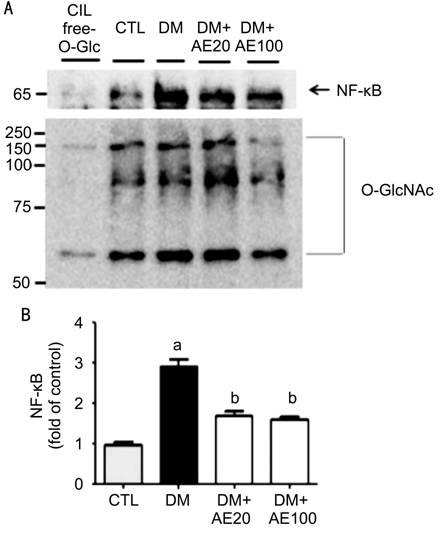 Basic Research Current Issue If In Jcr Citescore Rank Online Submission Articles In Press Pmc Rss Citation Kim Sj Kim Mj Choi My Kim Ys Yoo Jm Hong Ek Ju S Choi Ws Aralia Elata Inhibits Neurodegeneration By Downregulating O