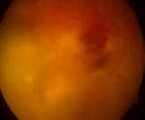 Fig_2