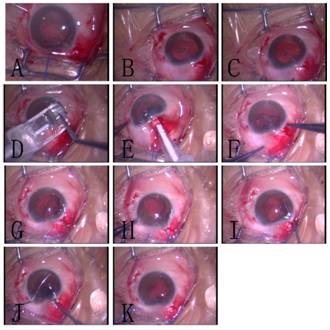 figure_2